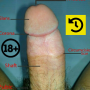 icon Penis Anatomy(Anatomia do pênis
)