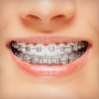 icon Braces (Suspensórios
)